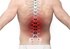 Low Back pain & Surgery
