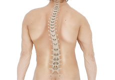 Kyphosis – Spinal Deformity
