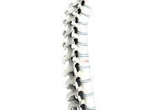 Vertebral Compression fracture, Vertebroplasty & Kyphoplasty